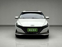 X9 1.5L CVT GLX Edition - фото 2