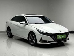 X9 1.5L CVT GLX Edition - фото 3