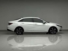 X9 1.5L CVT GLX Edition - фото 4