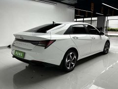 X9 1.5L CVT GLX Edition - фото 5