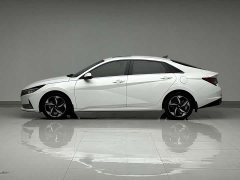 X9 1.5L CVT GLX Edition - фото 7
