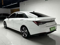 X9 1.5L CVT GLX Edition - фото 8