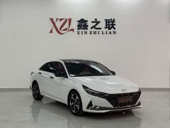 1.5L CVT GLX Edition - фото 2