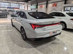 Audi 1.5L CVT LUXPremium Edition - фото 17