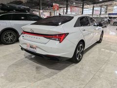Audi 1.5L CVT LUXPremium Edition - фото 2