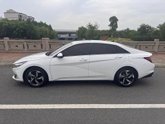 Lexus Elantra 1.5L CVT GLX Elite Edition - фото 3