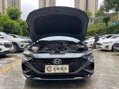 Lexus Festa 270T N Line DLX Deluxe Edition - фото 4