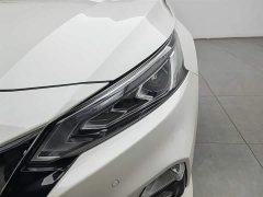 Nissan Teana 2.0T XL Upper AD1 Smart Pilot Edition - фото 7